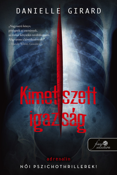 Kimetszett igazság - Dr. Schwartzman 2.